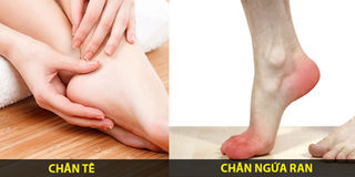 Những dấu hiệu của bàn chân mách bạn biết mình có bị bệnh gì nghiêm trọng hay không