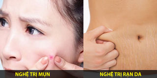 Chữa tất tần tật các bệnh về da chỉ bằng nghệ, mẹo quá hay mà bạn cần phải biết