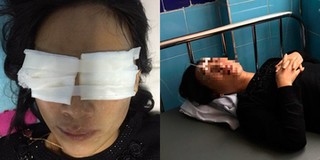 Quảng Bình: Mẹ chồng tạt axit vào mặt con dâu đã tử vong tại nhà riêng