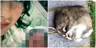 Kinh hoàng cặp đôi trẻ để chuột cắn hơn 100 lần trên khuôn mặt đứa con sơ sinh của mình