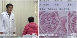 Dùng mỹ phẩm làm trắng da giá rẻ, người phụ nữ bị chẩn đoán mắc bệnh thận chỉ sau 2 tháng sử dụng