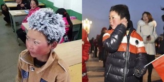Dân mạng bất ngờ với tin cậu bé tóc đóng băng bị đuổi học tại trường mới vì lý do không tưởng
