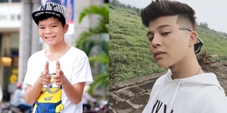 Quang Anh The Voice Kids tự tin khoe cận cảnh gương mặt sau phẫu thuật thẩm mỹ