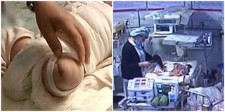 Xót xa bé sơ sinh 4 ngày tuổi bị cắt bỏ một bên chân chỉ vì sự bất cẩn của nữ y tá