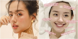 Khánh Linh The Face công khai chi phí phẫu thuật thẩm mỹ cả gương mặt