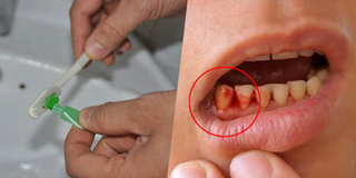 Những sự thật bạn cần biết về kem đánh răng để bảo vệ sức khỏe của mình và người thân