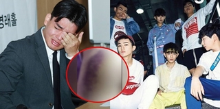 Tiết lộ bằng chứng boygroup Kpop bị bạo hành: Ảnh chụp vết thương rỉ máu, đoạn ghi âm đe dọa của CEO