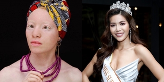 Thí sinh bạch tạng cũng là đối thủ của Minh Tú ở Hoa hậu siêu Quốc gia 2018