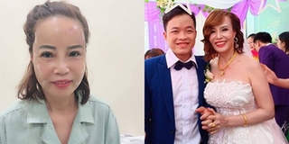 Cô dâu 61 tuổi tiết lộ lý do liều mạng đánh đổi cả sức khoẻ, tiền bạc để phẫu thuật thẩm mỹ