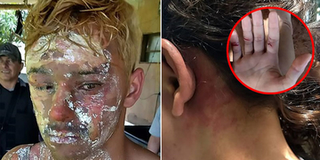Bắt cóc rồi cưỡng bức vợ cũ nhiều lần, nam thanh niên lãnh ngay cái kết không thể đắng hơn