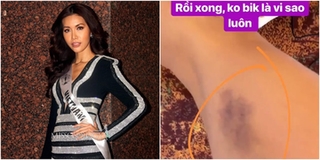 Mới ngày thứ 3 "chinh chiến" ở Miss Supranational 2018, Minh Tú đã gặp chấn thương
