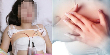 Góc Cảnh Giác: Người phụ nữ buộc phải cắt bỏ ngực trái vì phẫu thuật thẩm mỹ bị nhiễm trùng Góc Cảnh Giác: Người phụ nữ buộc phải cắt bỏ ngực trái vì phẫu thuật thẩm mỹ bị nhiễm trùng