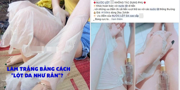 Góc Cảnh Giác: Nước lột da siêu tốc - Trắng bóc sau 60 phút coi chừng cả đời gánh hậu quả Góc Cảnh Giác: Nước lột da siêu tốc - Trắng bóc sau 60 phút coi chừng cả đời gánh hậu quả