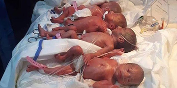 Chuyện kì diệu đầu năm mới: Người mẹ 25 tuổi sinh thường 7 em bé Chuyện kì diệu đầu năm mới: Người mẹ 25 tuổi sinh thường 7 em bé