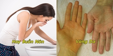 7 dấu hiệu cho thấy gan bạn đang gặp vấn đề, cần gặp bác sĩ gấp! 7 dấu hiệu cho thấy gan bạn đang gặp vấn đề, cần gặp bác sĩ gấp!