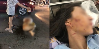 Vụ đánh ghen kinh hoàng đổ nước mắm, muối ớt tại Thanh Hóa: Đã có phán quyết cuối cùng