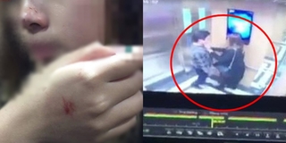 Vụ cô gái bị cưỡng hôn trong thang máy: Gã "dê xồm" sẽ xin lỗi công khai tại chung cư xảy ra sự việc