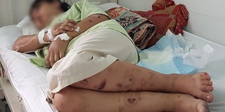 Thông tin mới nhất vụ cô gái trẻ bị giam giữ, đánh đập đến sinh non tại Sài Gòn