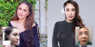 Câu chuyện "đập đi xây lại" của 5 mỹ nhân Thái: Muốn đẹp hãy bay thẳng sang Hàn Quốc!