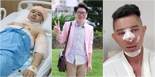 Loạt sao nam Việt phải cậy nhờ "dao kéo" vì không chịu nổi áp lực của dư luận
