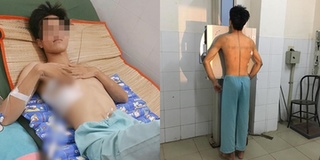 Nhập viện vì 6 năm hút thuốc, thanh niên gửi lời khuyên đến hàng triệu người: "Như chết đi sống lại"