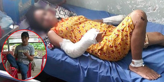 Gã "chồng hờ" đánh vợ đang mang thai đến gãy chân tay, vỡ đầu đã bị bắt khi đang lẩn trốn