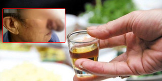 Nghiện rượu suốt năm 10, mũi cụ ông gần 80 tuổi dài ra như phù thủy