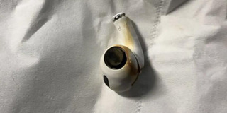 Người đàn ông ngất xỉu vì tai nghe AirPods phát nổ khi đang sử dụng