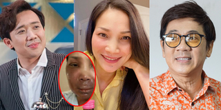 Sao Việt vỡ oà khi thấy Hồng Ngọc khoe cận gương mặt bình phục 100%