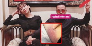 Giữa tin đồn mang thai, Tóc Tiên ép dẻo đến bầm cả chân