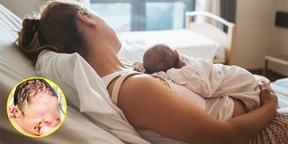 Em bé sơ sinh gây sốt khi nắm vòng tránh thai lúc chào đời