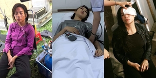 Xót cảnh sao Việt bị tai nạn nặng vẫn cương quyết quay tiếp vì ê-kíp