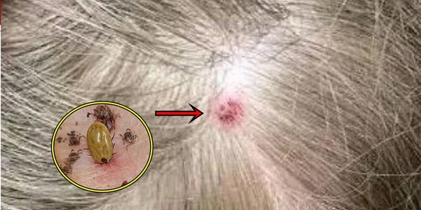 Thuốc xịt ngoài da diệt ve rận, bọ chét, ký sinh trùng cho chó mèo Hantox  (ht) – Kún Miu Pet shop & grooming
