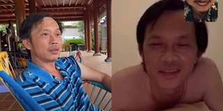 Khán giả lo lắng khi Hoài Linh lộ diện với gương mặt hốc hác, mắt thâm