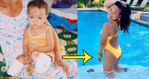 Cuộc sống đáng ngưỡng mộ sau 17 năm ở Mỹ của bé gái Việt mất đôi chân