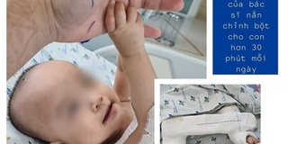 Trúc Nhi - Diệu Nhi sẽ tập đi trong 6 tuần tới sau khi cắt cây bột