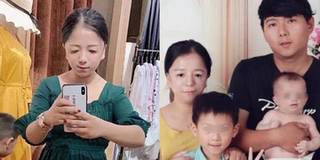 Hôn nhân viên mãn của cô gái dị tật lấy chồng điển trai, khoẻ mạnh