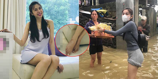 Bị hỏi chân còn ghẻ không sau khi đi từ thiện, Thủy Tiên chỉ nói 1 câu