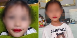 Lời giải thích gây tranh cãi của thẩm mỹ viện phun môi cho bé 5 tuổi