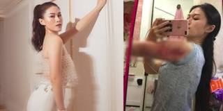 Ái nữ đại gia thủy sản hối hận vì "lười vận động", đi hút mỡ bắp tay