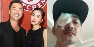Quốc Cường "Dốc Tình" gặp chấn thương ở mắt khiến dàn sao Việt lo lắng
