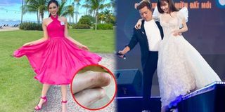 Nỗi khổ mỹ nhân Việt khi đi giày cao gót: Đỗ Hà trầy gót sau 4 ngày