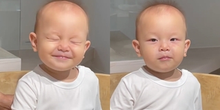 Bé Leon nổi ban do sốt siêu vi, khoe biểu cảm "meme" siêu dễ thương
