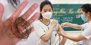 Hội chị em than thở vừa tiêm vaccine Covid-19, tóc đã rụng hói đầu